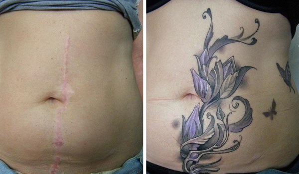 Tatuajes en el estómago para niñas después del parto para ocultar las estrías.