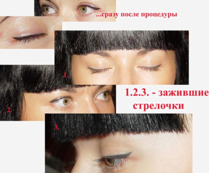 Trvalý make-up očních víček, typy, jak se to dělá, důsledky, korekce: mezi řasami, permanentní, šipky se stínováním, převislé víčko, fotografie před a po, recenze