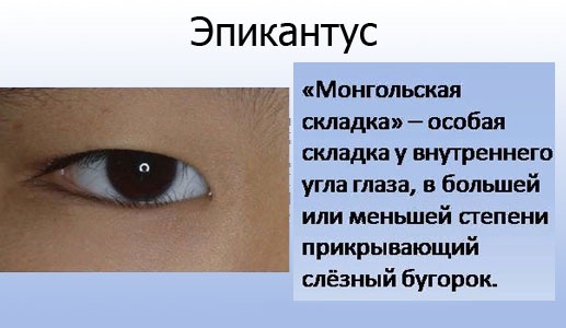 Formes d'ulls. Com identificar, foto i descripció, triar fletxes, maquillar-se perfectament