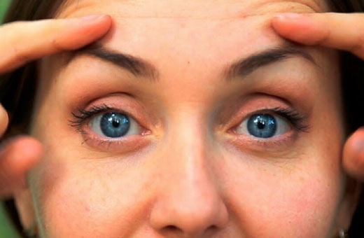 Comment enlever rapidement la paupière pendante sur les yeux à la maison. Conseils de cosmétologie