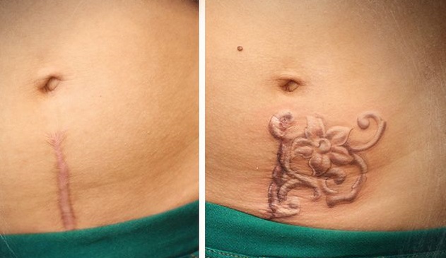 Pilvo tatuiruotė mergaitėms. Nuotraukos, eskizai gėlės, užrašai, gyvūnai, raštai