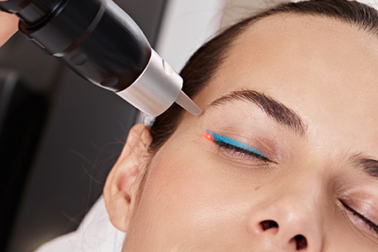 Laserowe usuwanie tatuaży oczu z powiek. Zdjęcia przed i po, konsekwencje