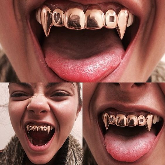 Grillit hampaisiin. Mikä se on, kulta, hopea, timantti, valkoinen. Hinta
