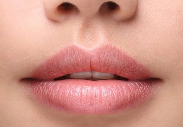 Butiran Fordyce dan solek bibir kekal. Sebelum dan selepas gambar, ulasan