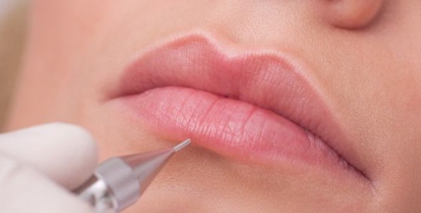 Granulado de Fordyce y maquillaje de labios permanente. Fotos de antes y después, reseñas