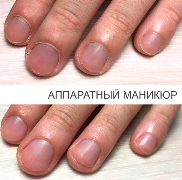 Manikura bez premaza. Fotografije prije i poslije, kako uljepšati